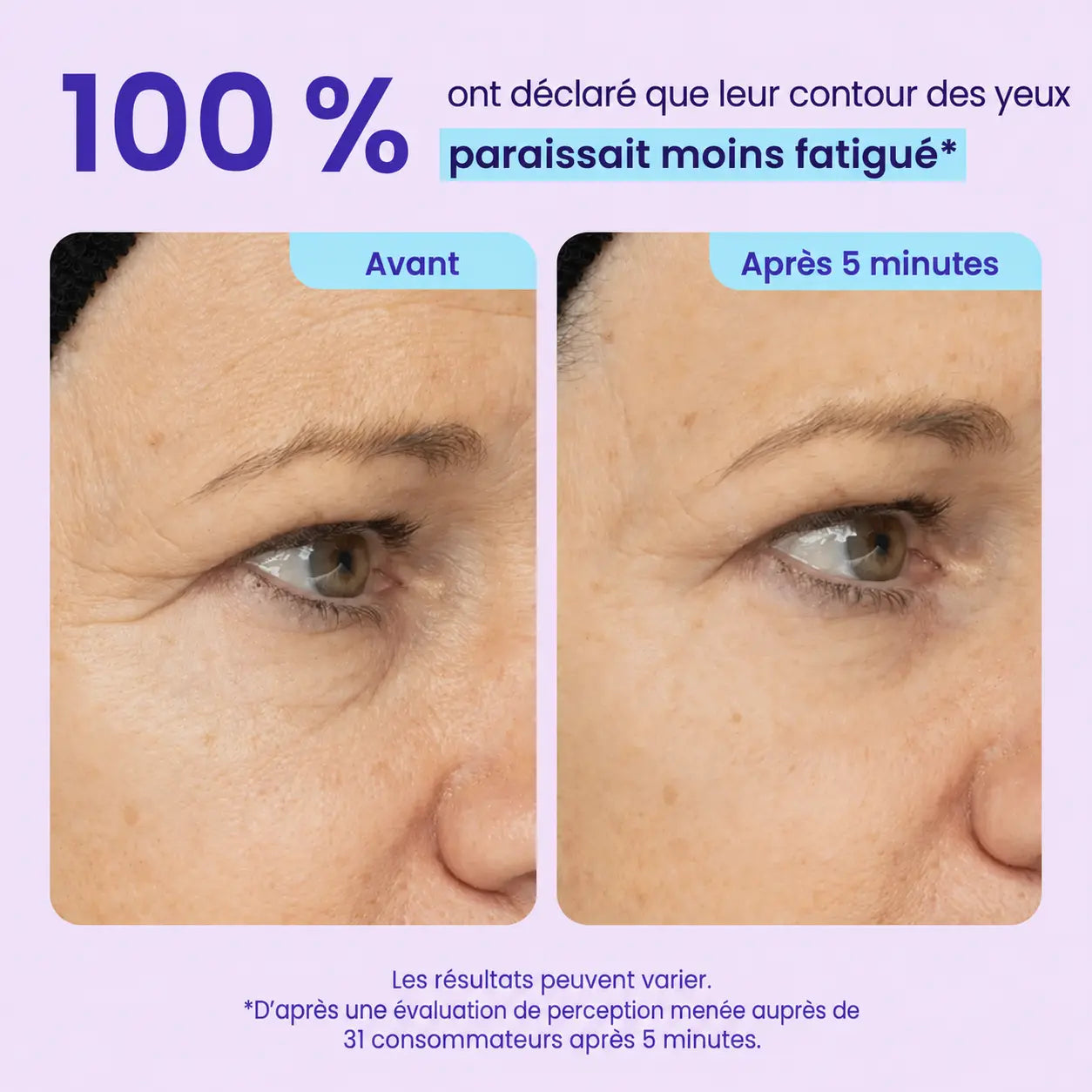 Gel Contour des Yeux Effet Liftant Immédiat