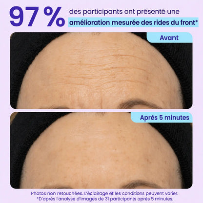 Gel Contour des Yeux Effet Liftant Immédiat