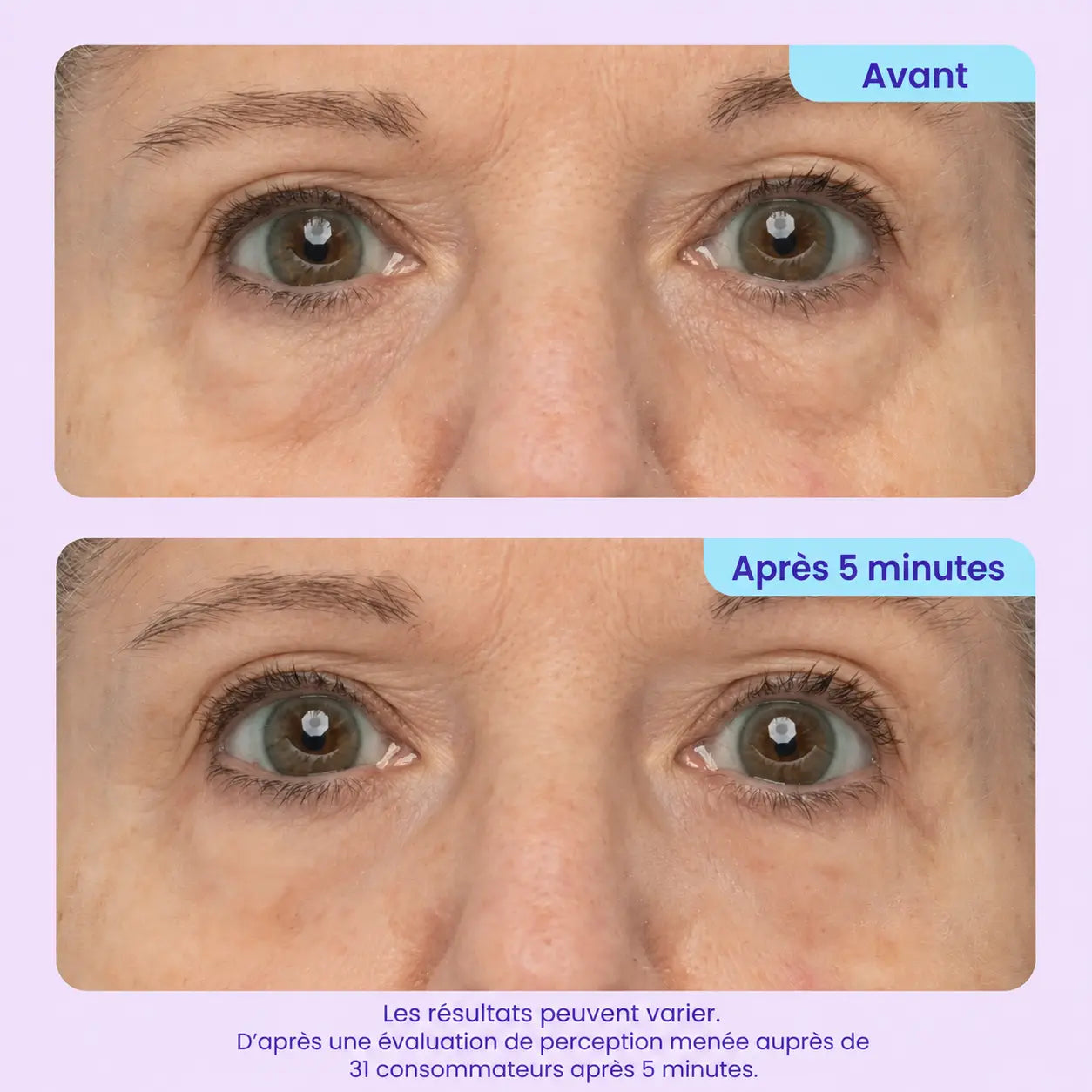 Gel Contour des Yeux Effet Liftant Immédiat
