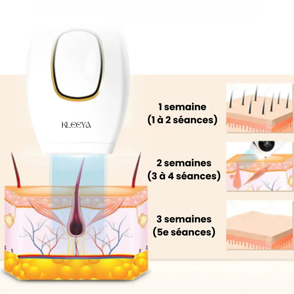 Épilateur IPL kleeya™