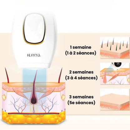 Épilateur IPL kleeya™