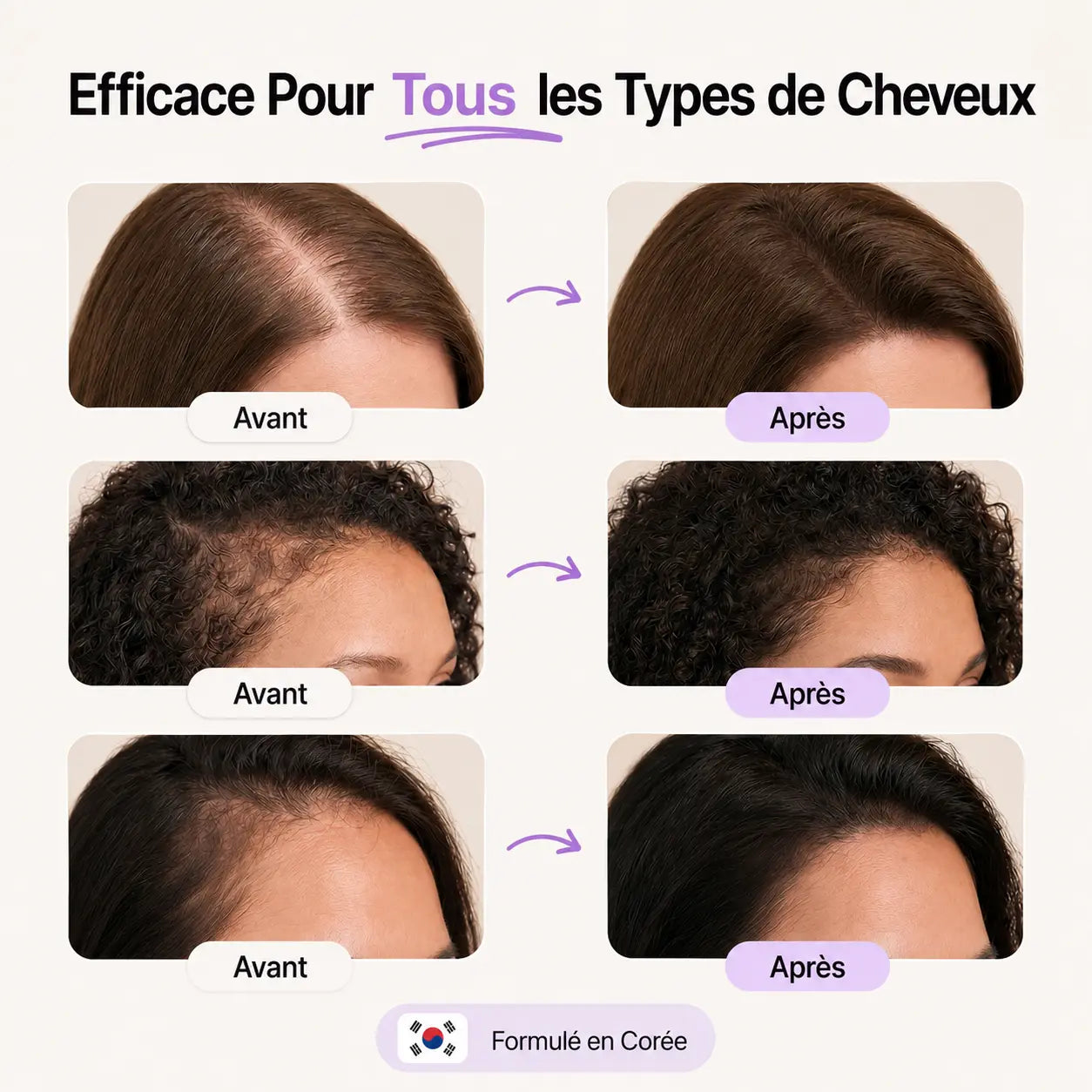 Kleeya™ Sérum Coréen Pousse & Densité
